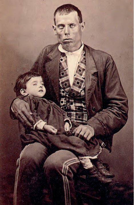 Padre con su hija difunta. José Rodrigo. 1875.